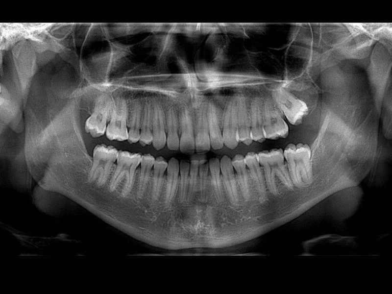 ANDRES FELIPE MARIN BETANCOURT