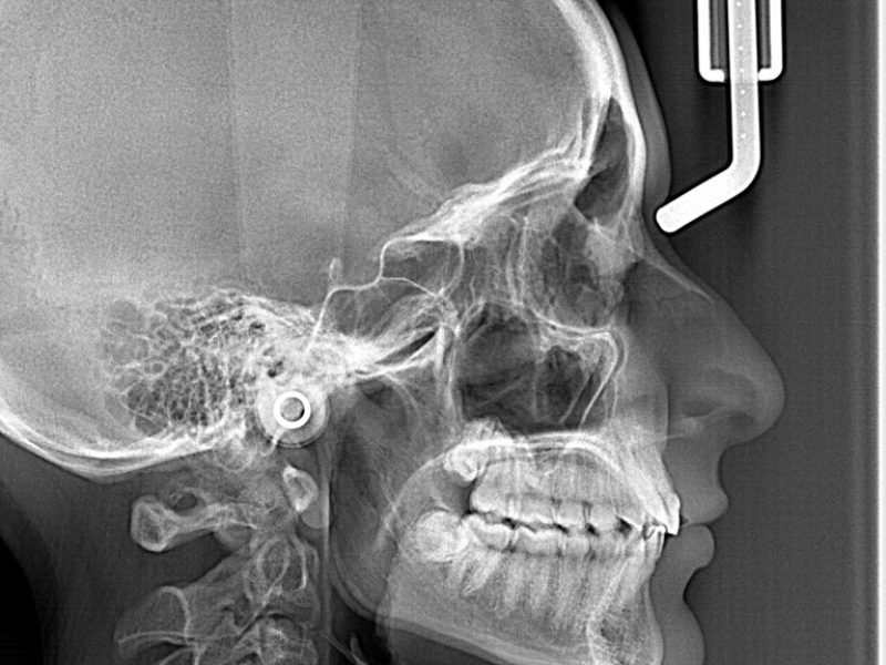 MARIA JOSE MONTOYA MEJIA